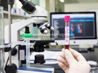 Pretreatment Polipeptida Pengaktif Adenilat Siklase Pituitary (PACAP) Meningkatkan Integritas Penghalang Darah-Otak (BBB) pada Sepsis dengan Mengaktifkan Jalur Sinyal Wnt3a/β-Catenin/Claudin-1