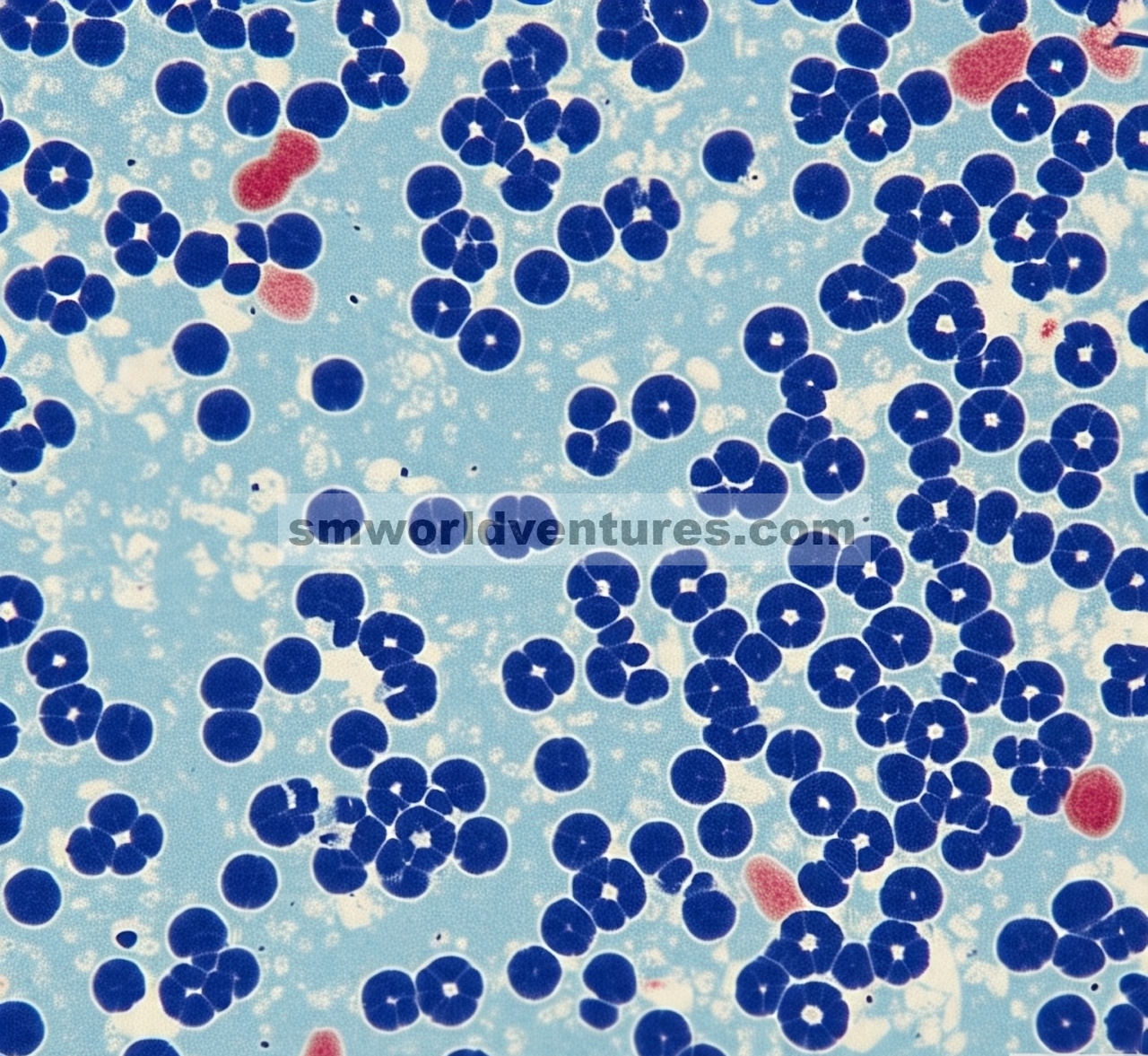 Distribusi subseluler protein pengikat Y-box terfosforilasi-1 di S102 pada pasien kanker kolorektal, dikelompokkan berdasarkan status mutasi KRAS dan fitur klinikopatologis